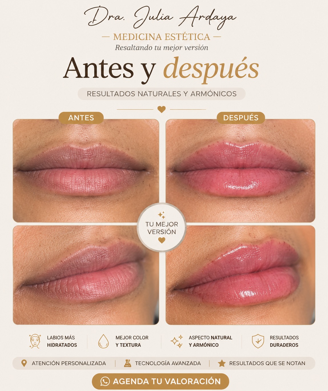 Antes y después de tratamiento — Dra. Julia Ardaya