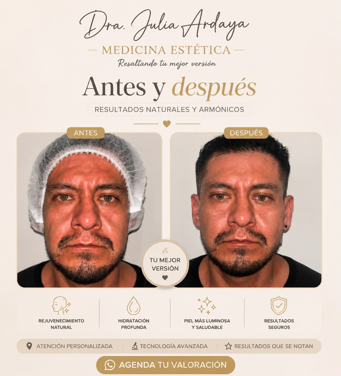 Antes y después de tratamiento — Dra. Julia Ardaya