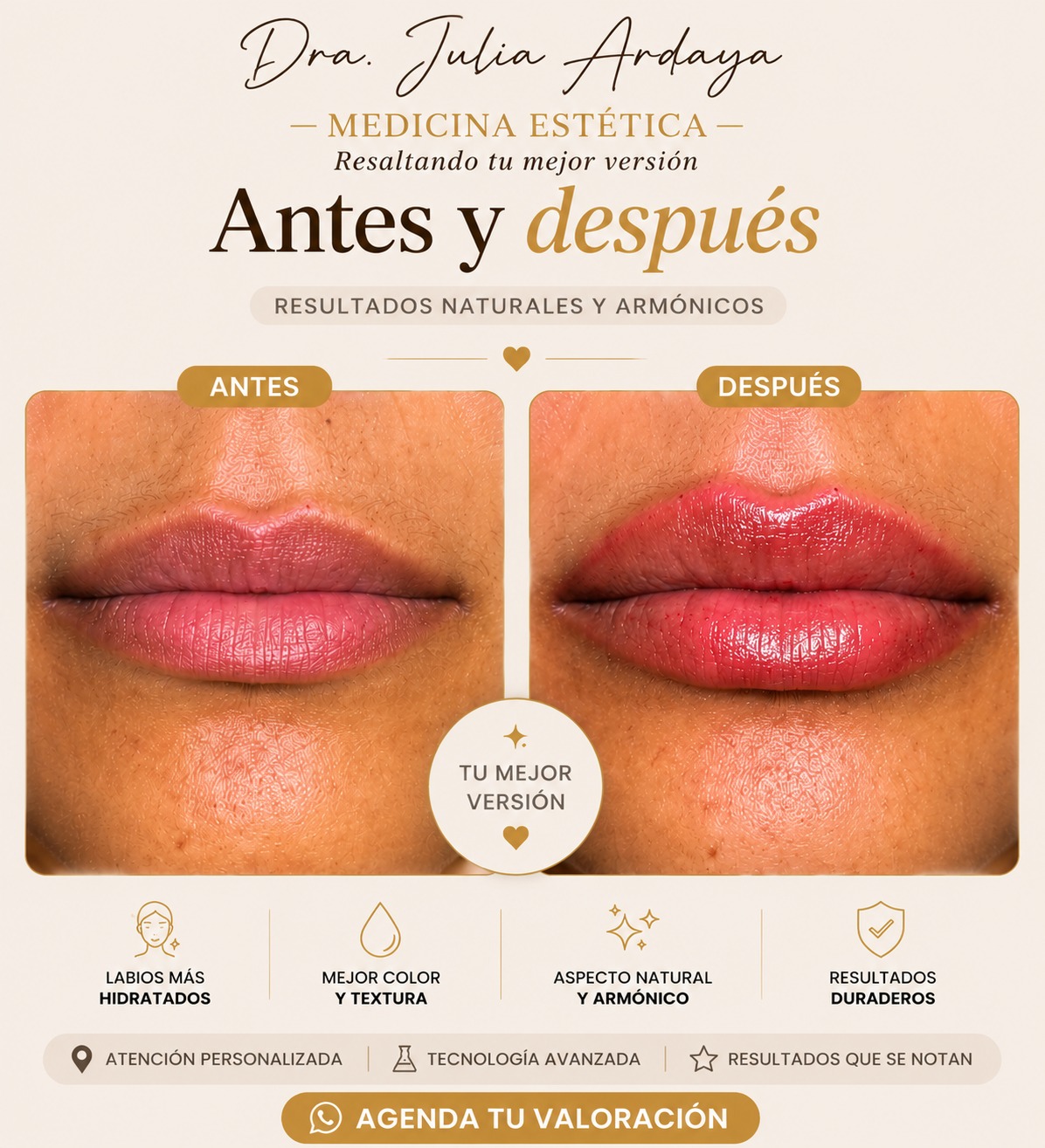 Antes y después de tratamiento — Dra. Julia Ardaya