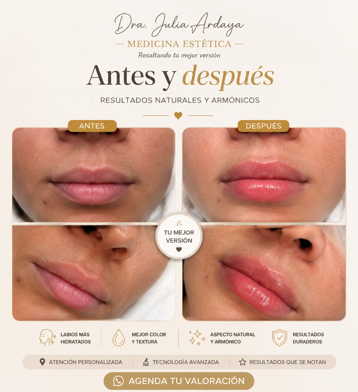 Antes y después de tratamiento — Dra. Julia Ardaya