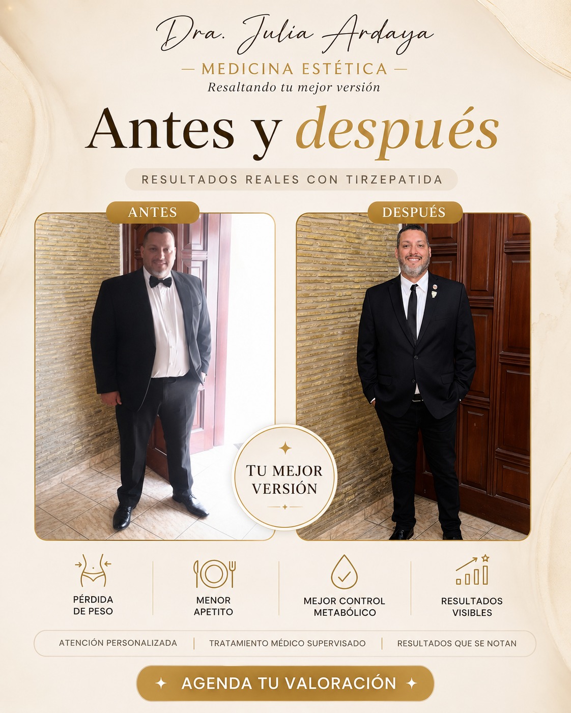 Antes y después de tratamiento — Dra. Julia Ardaya